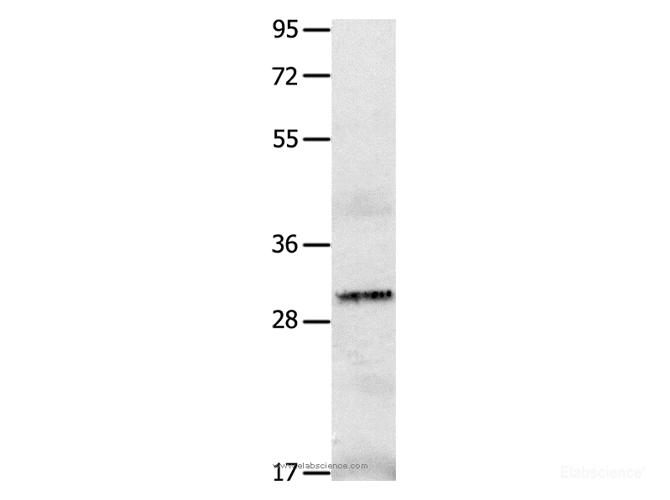 Western Blot analysis of A549 cell   using IL2RA Polyclonal Antibody at dilution of 1:750