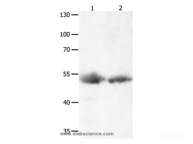 Western Blot analysis of Human lymphoma and liver cancer tissue  using JNK1 Polyclonal Antibody at dilution of 1:1000