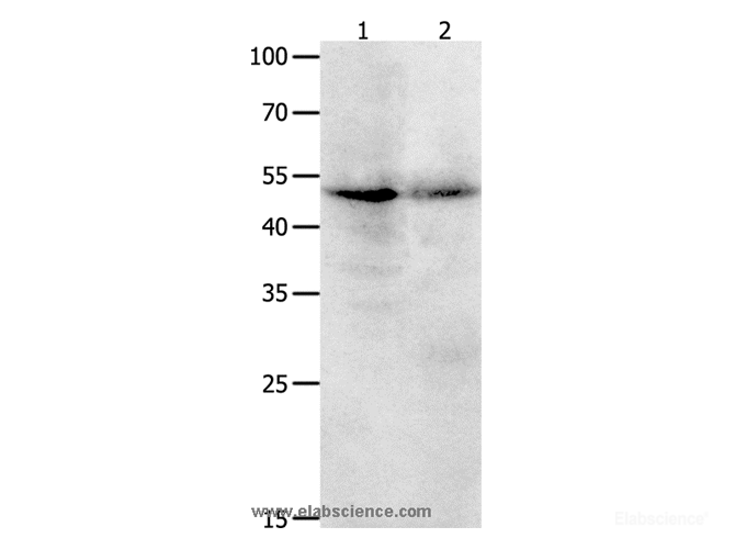 Western Blot analysis of Jurkat cell  and Human ovarian cancer tissue   using KLF5 Polyclonal Antibody at dilution of 1:1700