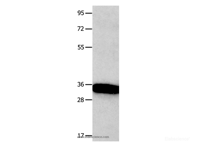 Western Blot analysis of Mouse brain tissue   using KLK5 Polyclonal Antibody at dilution of 1:1600
