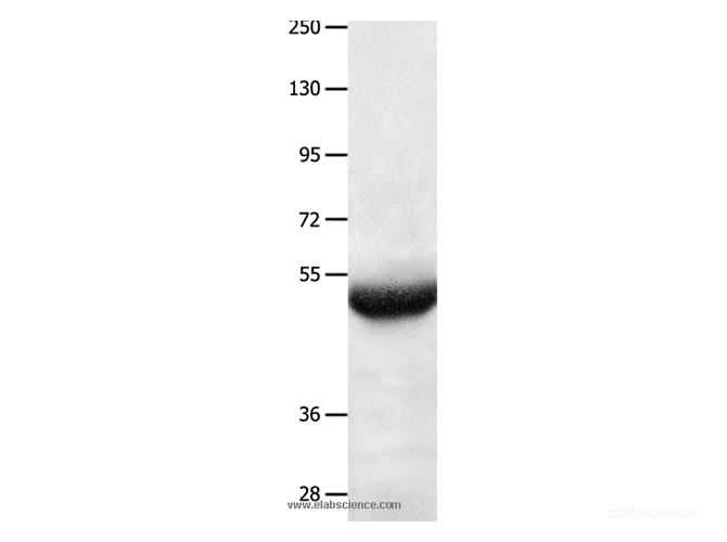 Western Blot analysis of Human lung cancer tissue   using BPIFB3 Polyclonal Antibody at dilution of 1:550