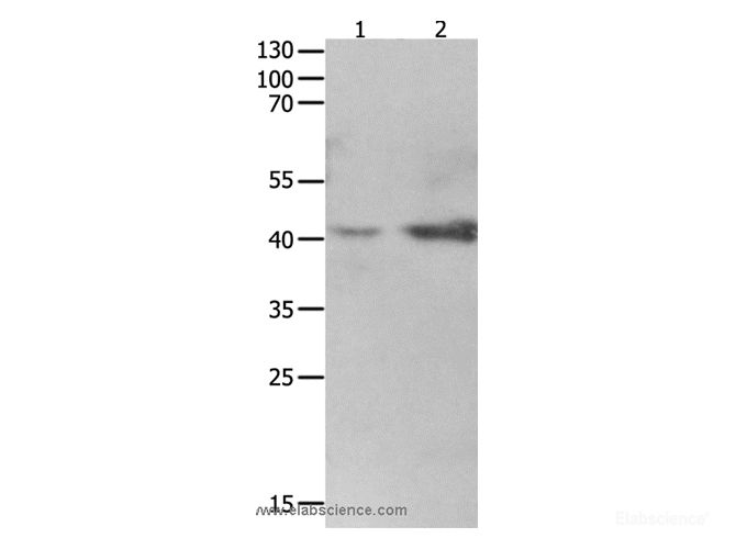 Western Blot analysis of 293T cell and fetal kidney tissue   using LRPAP1 Polyclonal Antibody at dilution of 1:1600