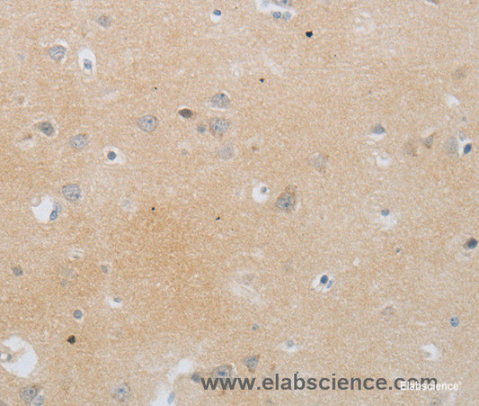 Immunohistochemistry of paraffin-embedded Human brain tissue using MMP25 Polyclonal Antibody at dilution 1:80