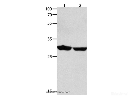 Western Blot analysis of Human brain malignant glioma and laryngocarcinoma tissue  using 14-3-3 epsilon Polyclonal Antibody at dilution of 1:1300