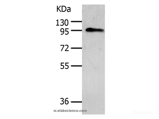 Western Blot analysis of Human liver cancer tissue using AKAP8 Polyclonal Antibody at dilution of 1:500