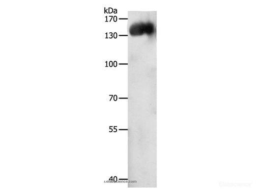 Western Blot analysis of Jurkat cell using CD31 Polyclonal Antibody at dilution of 1:500