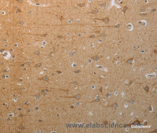 Immunohistochemistry of paraffin-embedded Human brain tissue using SLC4A7 Polyclonal Antibody at dilution 1:50