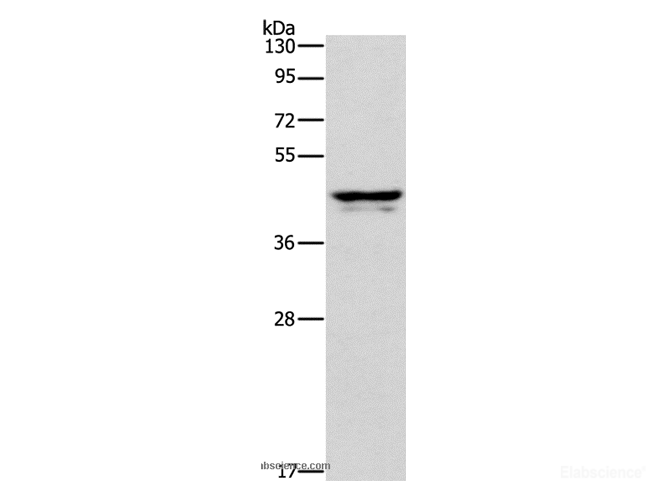 Western Blot analysis of Human plasma tissue using APOL1 Polyclonal Antibody at dilution of 1:400