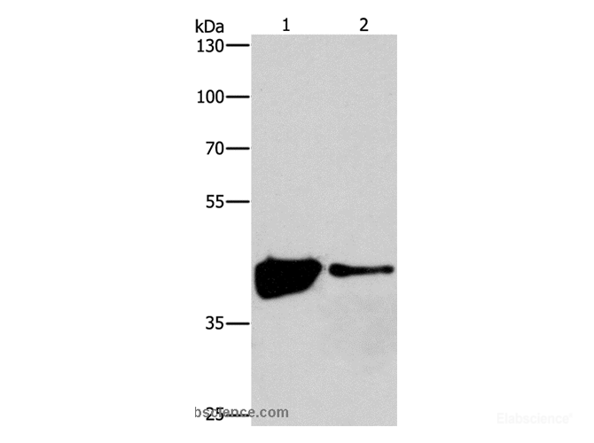 Western Blot analysis of 293T and Human fetal brain tissue using MAPK11  Polyclonal Antibody at dilution of 1:200