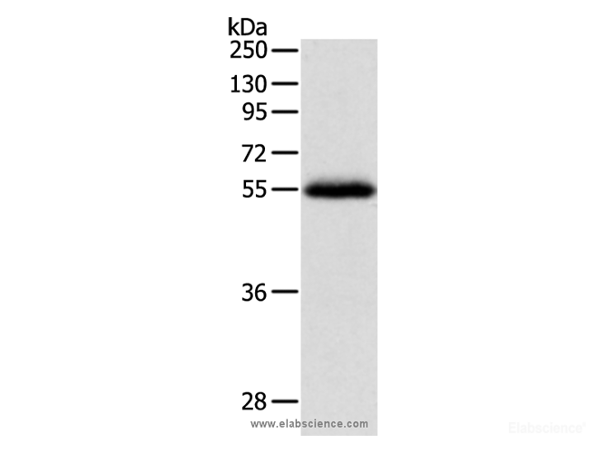 Western Blot analysis of Human leiomyosarcoma tissue using NPY1R Polyclonal Antibody at dilution of 1:400