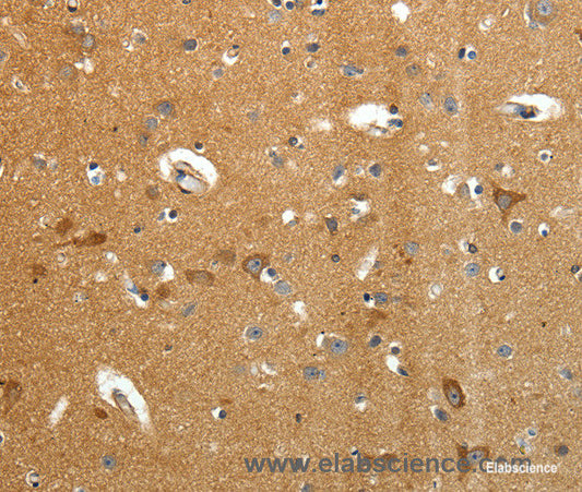 Immunohistochemistry of paraffin-embedded Human brain tissue using AMD1 Polyclonal Antibody at dilution 1:40