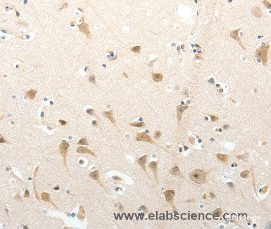 Immunohistochemistry of paraffin-embedded Human brain tissue using SEMA3D Polyclonal Antibody at dilution 1:50