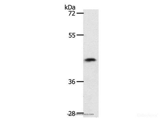 Western Blot analysis of 231 cell using PLAT Polyclonal Antibody at dilution of 1:450