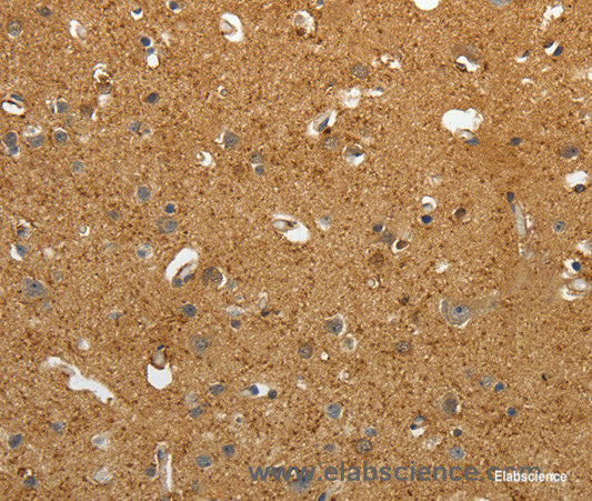 Immunohistochemistry of paraffin-embedded Human brain tissue using AKAP12 Polyclonal Antibody at dilution 1:40