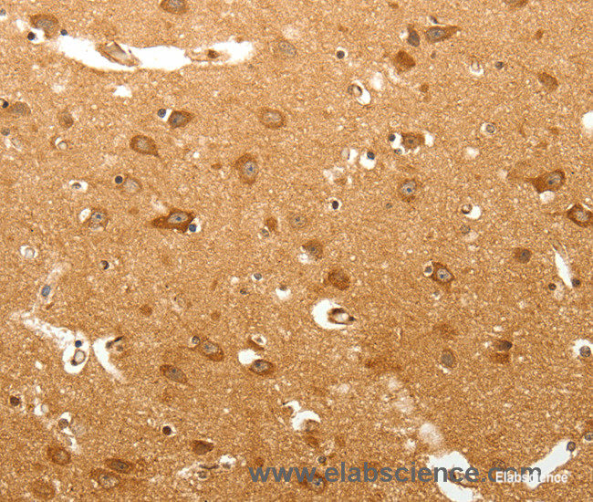 Immunohistochemistry of paraffin-embedded Human brain tissue using MAP1B  Polyclonal Antibody at dilution 1:60
