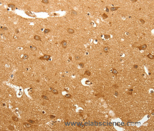 Immunohistochemistry of paraffin-embedded Human brain tissue using MAP1B  Polyclonal Antibody at dilution 1:60