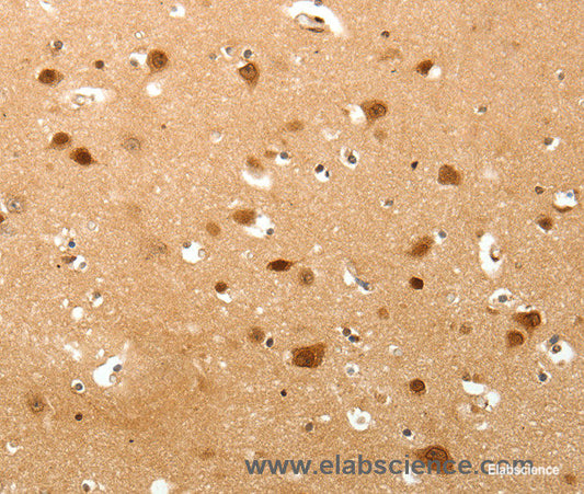 Immunohistochemistry of paraffin-embedded Human brain tissue using TNN Polyclonal Antibody at dilution 1:40