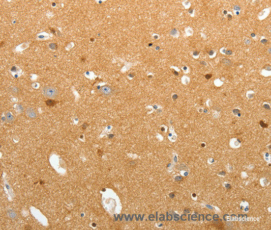Immunohistochemistry of paraffin-embedded Human brain tissue using TNR Polyclonal Antibody at dilution 1:60