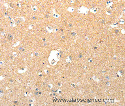Immunohistochemistry of paraffin-embedded Human brain tissue using TNXB Polyclonal Antibody at dilution 1:40
