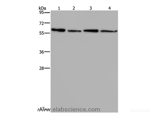Western Blot analysis of Mouse kidney, liver, heart and brain tissue using CD297 Polyclonal Antibody at dilution of 1:667