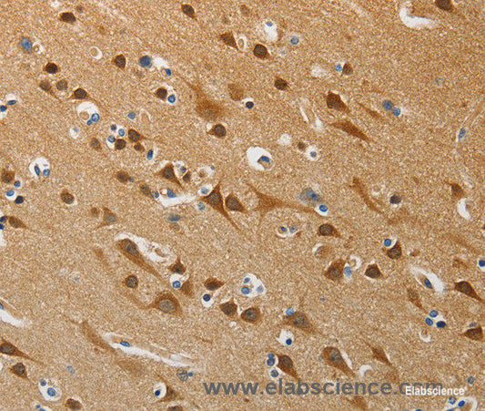 Immunohistochemistry of paraffin-embedded Human brain tissue using ATG4B Polyclonal Antibody at dilution 1:50