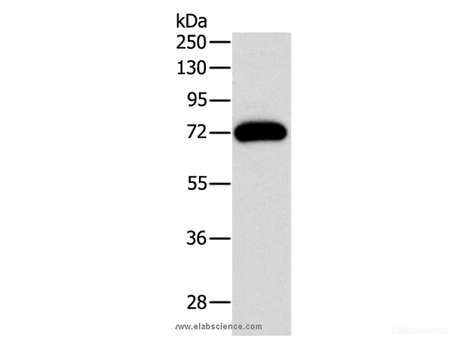 Western Blot analysis of Mouse brain tissue using PKC gamma Polyclonal Antibody at dilution of 1:500