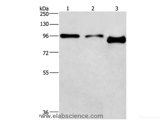 Western Blot analysis of A431 and hela cell,Mouse brain tissue using PIP5K1C Polyclonal Antibody at dilution of 1:500