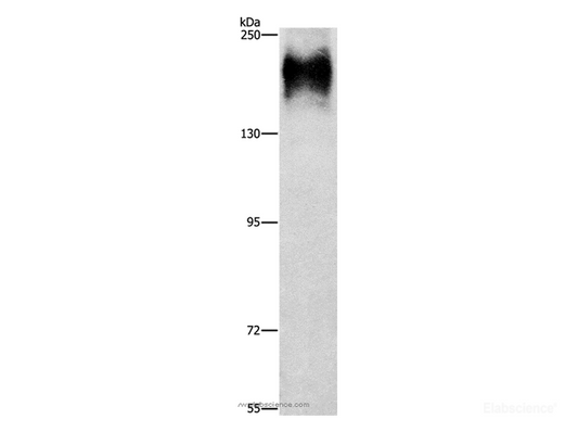Western Blot analysis of HepG2 cell using ATP7A  Polyclonal Antibody at dilution of 1:800