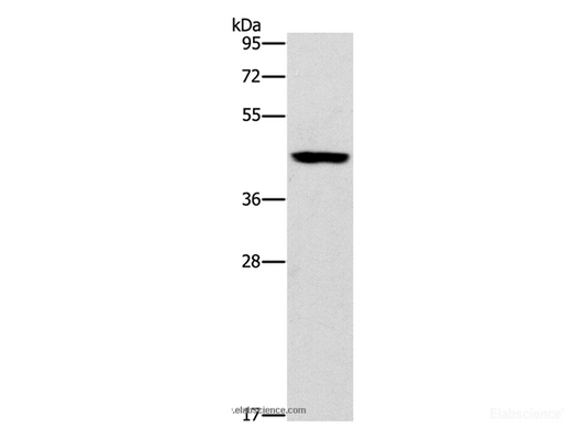 Western Blot analysis of Mouse brain tissue using B3GAT1 Polyclonal Antibody at dilution of 1:400