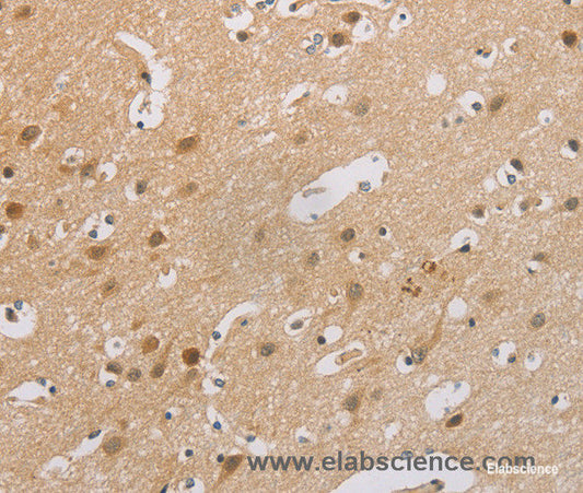 Immunohistochemistry of paraffin-embedded Human brain tissue using p16 Polyclonal Antibody at dilution 1:60