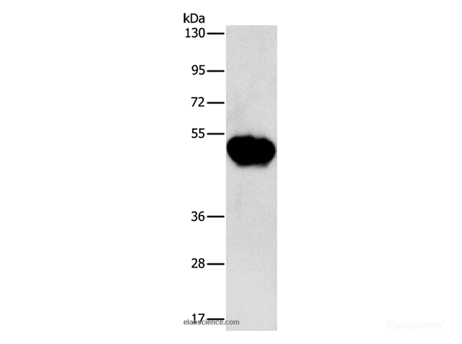 Western Blot analysis of Human fetal brain tissue using CHRDL2 Polyclonal Antibody at dilution of 1:600