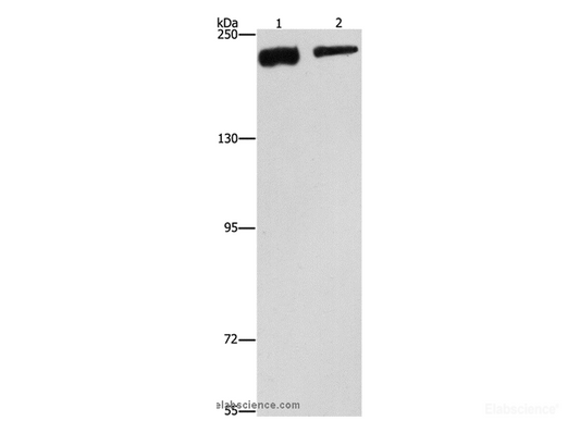 Western Blot analysis of NIH/3T3 and hela cell using CLTC Polyclonal Antibody at dilution of 1:300