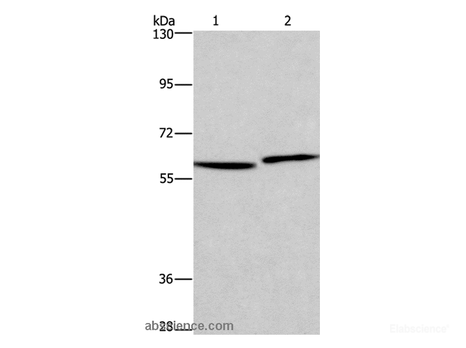 Western Blot analysis of Human testis and prostate tissue   using HAS1 Polyclonal Antibody at dilution of 1:350
