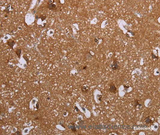 Immunohistochemistry of paraffin-embedded Human brain tissue using LIMK1 Polyclonal Antibody at dilution 1:40
