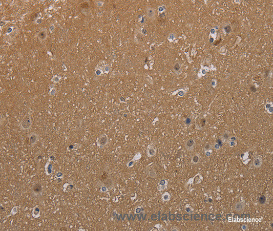 Immunohistochemistry of paraffin-embedded Human brain tissue using MAGEL2 Polyclonal Antibody at dilution 1:40