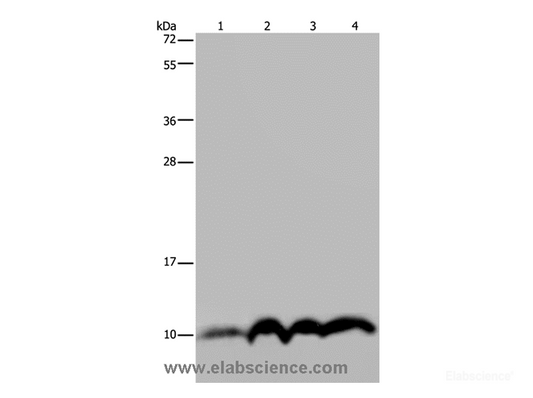 Western Blot analysis of SKOV3 cell and Human fetal liver tissue, Human fetal brain tissue and Hela cell using NDUFA4 Polyclonal Antibody at dilution of 1:300