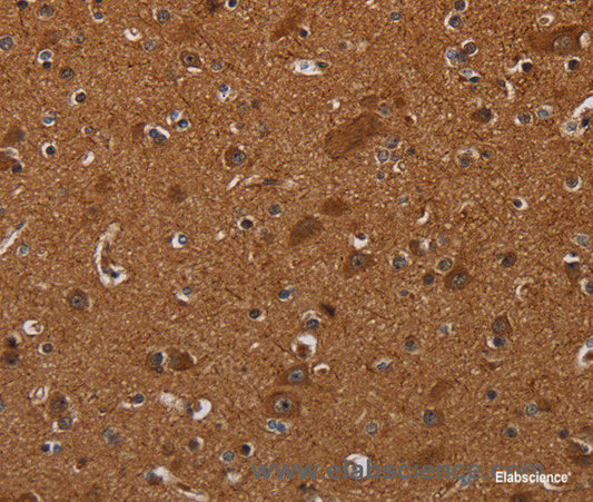 Immunohistochemistry of paraffin-embedded Human brain tissue using CYBB Polyclonal Antibody at dilution 1:40