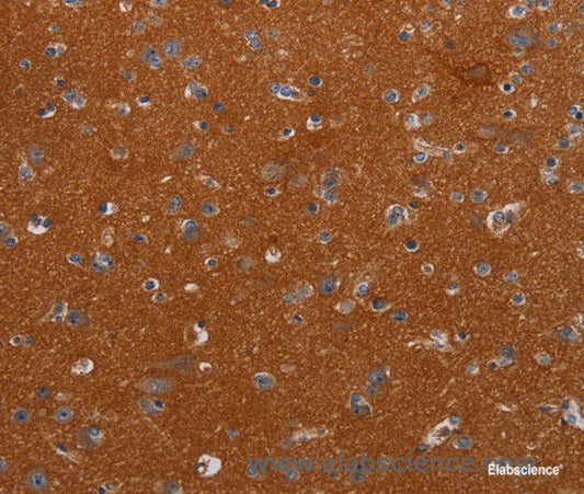 Immunohistochemistry of paraffin-embedded Human brain tissue using NOX3 Polyclonal Antibody at dilution 1:40