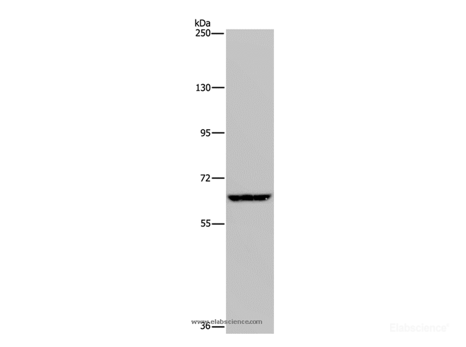 Western Blot analysis of Hela cell using IVL Polyclonal Antibody at dilution of 1:200