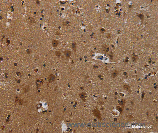 Immunohistochemistry of paraffin-embedded Human brain tissue using PCDHB11 Polyclonal Antibody at dilution 1:50