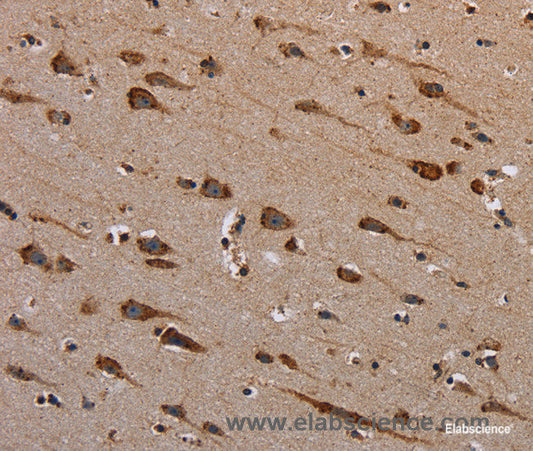 Immunohistochemistry of paraffin-embedded Human brain tissue using PLXNB1 Polyclonal Antibody at dilution 1:40