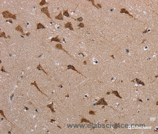 Immunohistochemistry of paraffin-embedded Human brain tissue using POMT1 Polyclonal Antibody at dilution 1:40