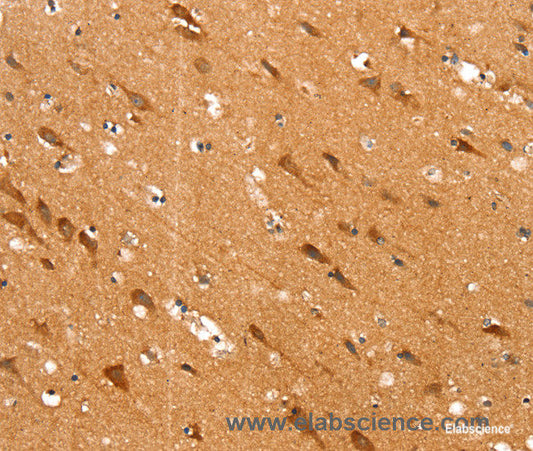 Immunohistochemistry of paraffin-embedded Human brain tissue using SLC25A12 Polyclonal Antibody at dilution 1:30