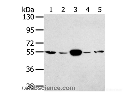 Western Blot analysis of Hela and K562 cell, Human fetal muscle tissue, A375 and hepg2 cell using TRIM35 Polyclonal Antibody at dilution of 1:400