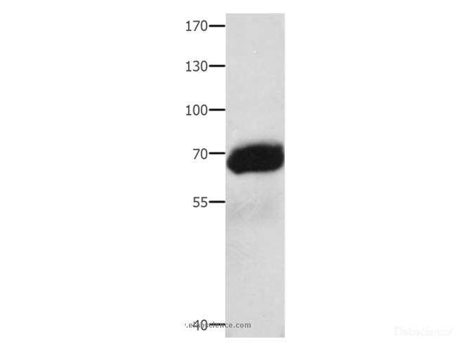 Western Blot analysis of Human liver cancer tissue  using AFP Polyclonal Antibody at dilution of 1:1000