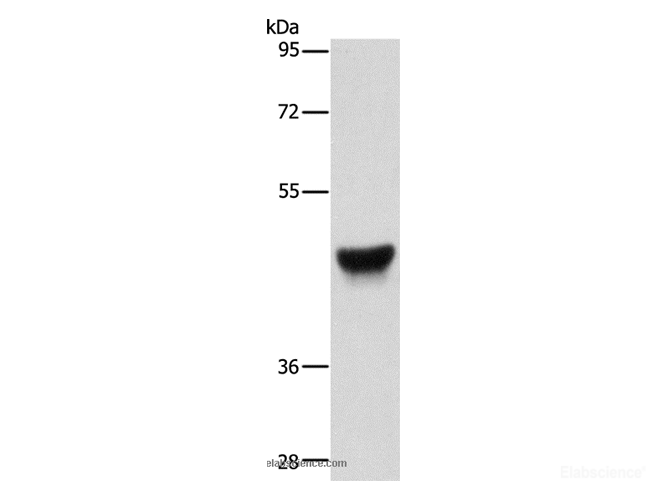 Western Blot analysis of Human esophagus cancer tissue using CK-13 Polyclonal Antibody at dilution of 1:500