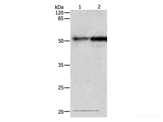 Western Blot analysis of Human fetal kidney and lung tissue using CASP2 Polyclonal Antibody at dilution of 1:950