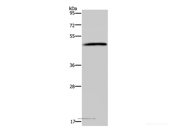 Western Blot analysis of 293T cell using HTR2B Polyclonal Antibody at dilution of 1:500