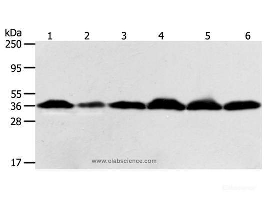Western Blot analysis of Hela cell and Human liver cancer tissue, Raji, Jurkat, 293T and PC3 cell using APEX1 Polyclonal Antibody at dilution of 1:450