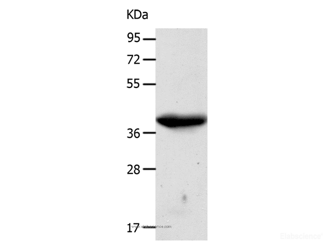 Western Blot analysis of A549 cell  using CDK7 Polyclonal Antibody at dilution of 1:500